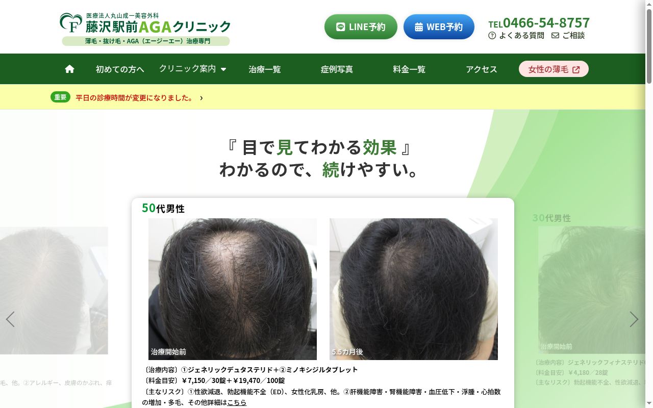 医療法人丸山成一美容外科 藤沢駅前AGAクリニックの公式サイトのスクリーンショット
