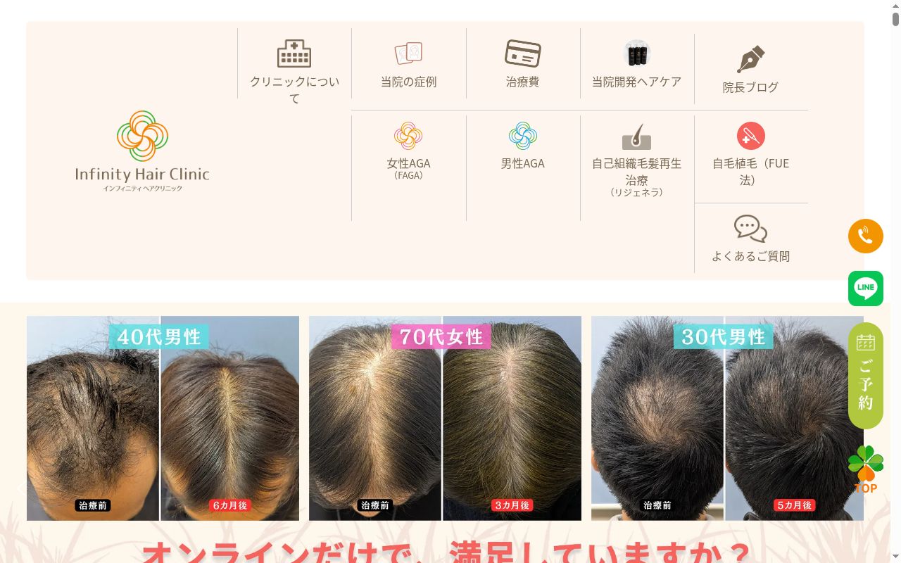 インフィニティヘアクリニックの公式サイトのスクリーンショット